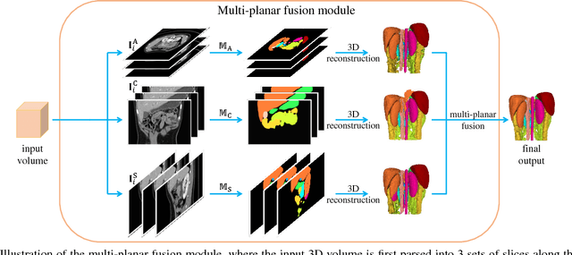 Figure 3 for Semi-Supervised Multi-Organ Segmentation via Deep Multi-Planar Co-Training