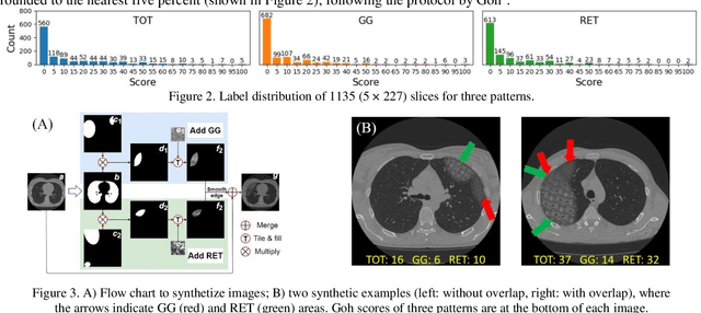 Figure 4 for Prediction of Lung CT Scores of Systemic Sclerosis by Cascaded Regression Neural Networks