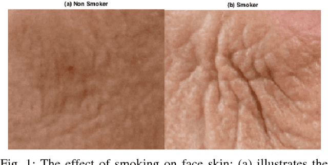 Figure 1 for Automated Assessment of Facial Wrinkling: a case study on the effect of smoking