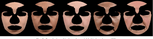 Figure 2 for Automated Assessment of Facial Wrinkling: a case study on the effect of smoking