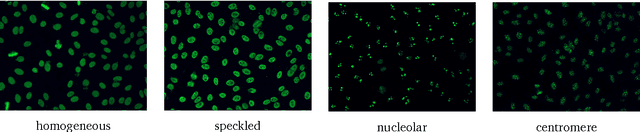 Figure 1 for Automatic Classification of Human Epithelial Type 2 Cell Indirect Immunofluorescence Images using Cell Pyramid Matching
