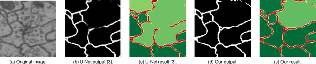 Figure 1 for BuyTheDips: PathLoss for improved topology-preserving deep learning-based image segmentation