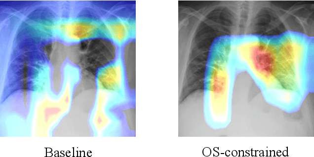 Figure 1 for Interpretable COVID-19 Chest X-Ray Classification via Orthogonality Constraint