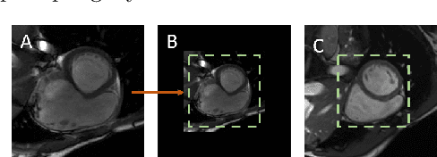 Figure 4 for Tempera: Spatial Transformer Feature Pyramid Network for Cardiac MRI Segmentation