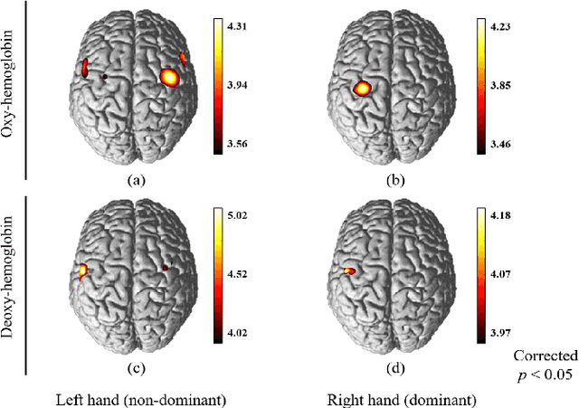 Figure 1 for Classification of fNIRS Data Under Uncertainty: A Bayesian Neural Network Approach