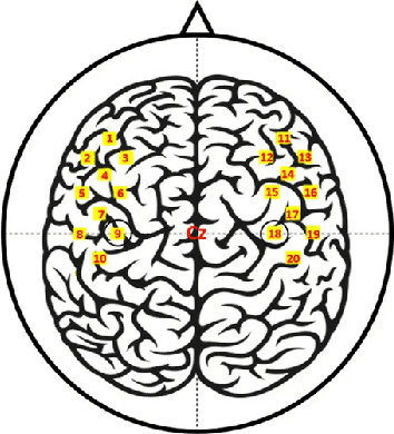 Figure 2 for Classification of fNIRS Data Under Uncertainty: A Bayesian Neural Network Approach