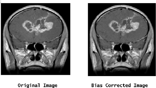 Figure 3 for Detection and Classification of Brain tumors Using Deep Convolutional Neural Networks
