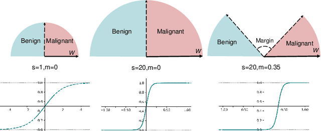 Figure 3 for Deep Angular Embedding and Feature Correlation Attention for Breast MRI Cancer Analysis