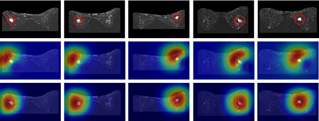 Figure 4 for Deep Angular Embedding and Feature Correlation Attention for Breast MRI Cancer Analysis