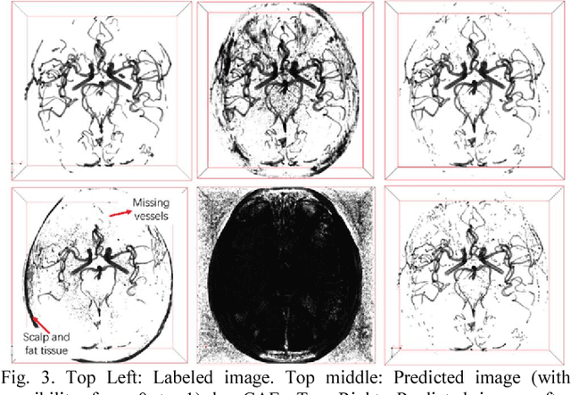 Figure 3 for Y-net: 3D intracranial artery segmentation using a convolutional autoencoder