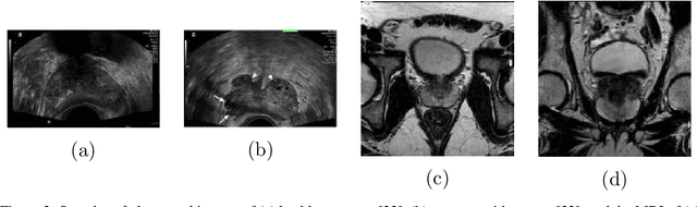 Figure 2 for Capsule GAN for Prostate MRI Super-Resolution
