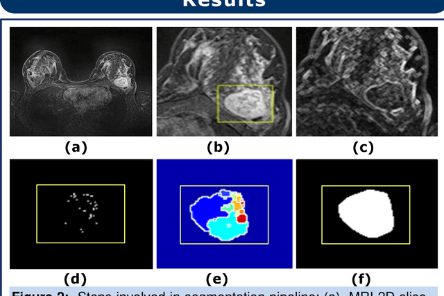 Figure 2 for Semi-Automatic Algorithm for Breast MRI Lesion Segmentation Using Marker-Controlled Watershed Transformation