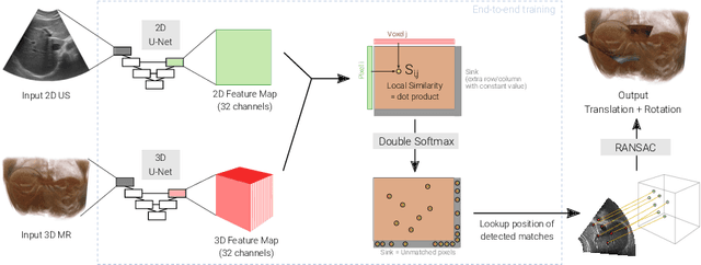 Figure 1 for Global Multi-modal 2D/3D Registration via Local Descriptors Learning