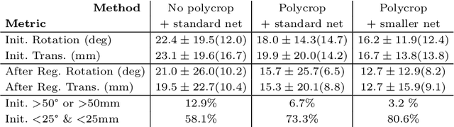 Figure 4 for Global Multi-modal 2D/3D Registration via Local Descriptors Learning