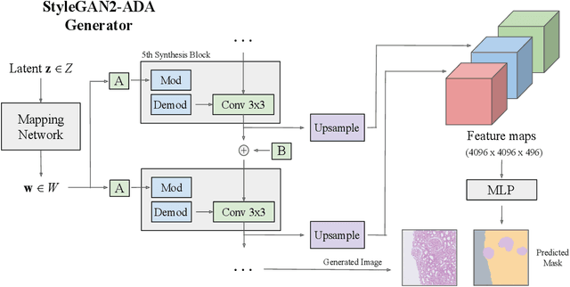 Figure 1 for Histopathology DatasetGAN: Synthesizing Large-Resolution Histopathology Datasets