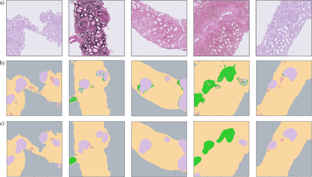 Figure 3 for Histopathology DatasetGAN: Synthesizing Large-Resolution Histopathology Datasets