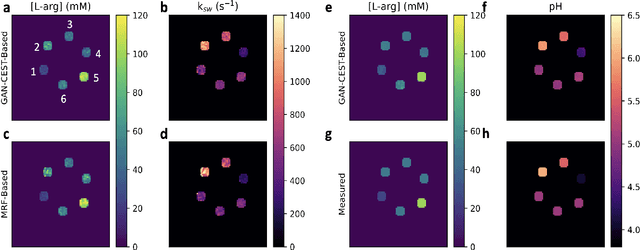 Figure 3 for Accelerated and Quantitative 3D Semisolid MT/CEST Imaging using a Generative Adversarial Network (GAN-CEST)