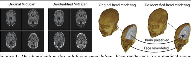 Figure 1 for Conditional De-Identification of 3D Magnetic Resonance Images