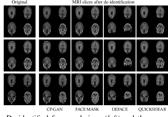 Figure 4 for Conditional De-Identification of 3D Magnetic Resonance Images