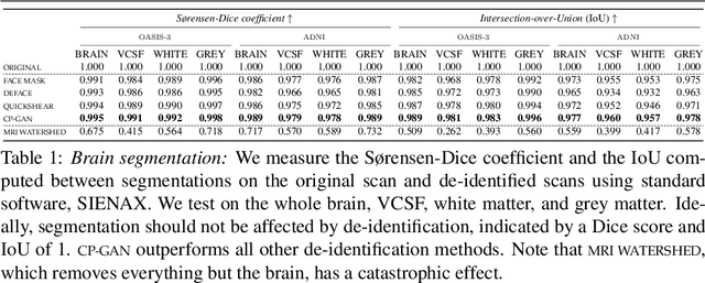 Figure 2 for Conditional De-Identification of 3D Magnetic Resonance Images