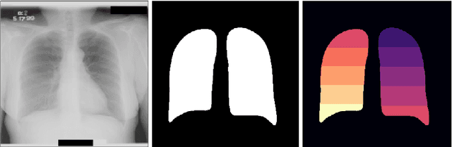 Figure 3 for Learning to recognize Abnormalities in Chest X-Rays with Location-Aware Dense Networks