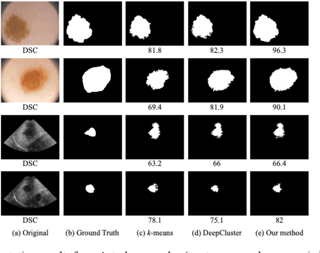 Figure 4 for A Spatial Guided Self-supervised Clustering Network for Medical Image Segmentation