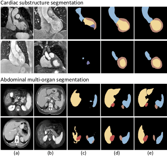 Figure 1 for Unsupervised Bidirectional Cross-Modality Adaptation via Deeply Synergistic Image and Feature Alignment for Medical Image Segmentation