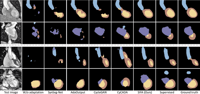 Figure 3 for Unsupervised Bidirectional Cross-Modality Adaptation via Deeply Synergistic Image and Feature Alignment for Medical Image Segmentation