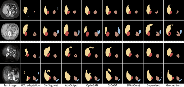 Figure 4 for Unsupervised Bidirectional Cross-Modality Adaptation via Deeply Synergistic Image and Feature Alignment for Medical Image Segmentation