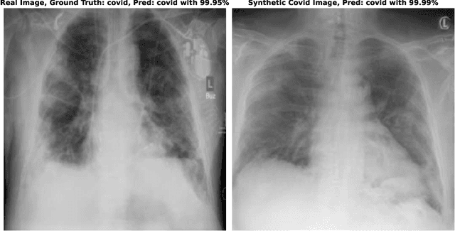 Figure 3 for Improving COVID-19 CXR Detection with Synthetic Data Augmentation