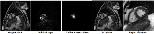 Figure 3 for Automatic CNN-based detection of cardiac MR motion artefacts using k-space data augmentation and curriculum learning