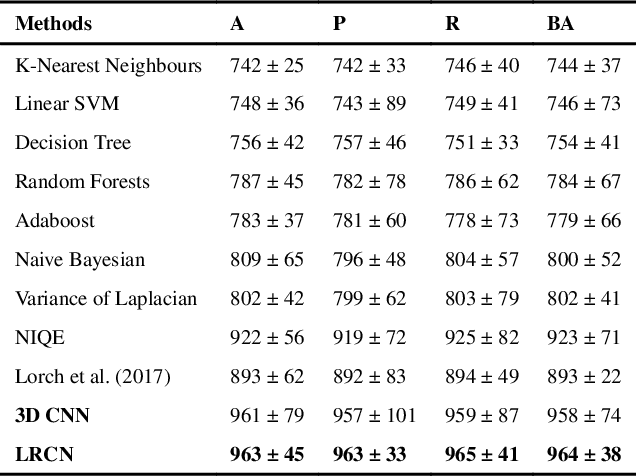 Figure 2 for Automatic CNN-based detection of cardiac MR motion artefacts using k-space data augmentation and curriculum learning