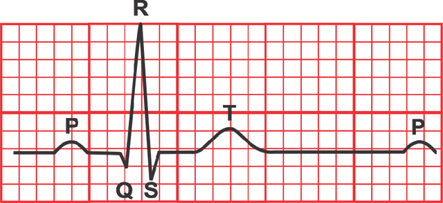 Figure 1 for Unsupervised Heart-rate Estimation in Wearables With Liquid States and A Probabilistic Readout
