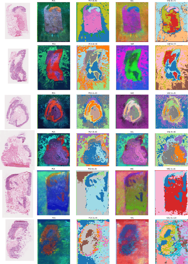 Figure 4 for Variational autoencoders for tissue heterogeneity exploration from (almost) no preprocessed mass spectrometry imaging data