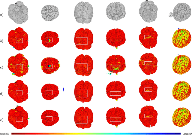 Figure 3 for Brain Surface Reconstruction from MRI Images Based on Segmentation Networks Applying Signed Distance Maps