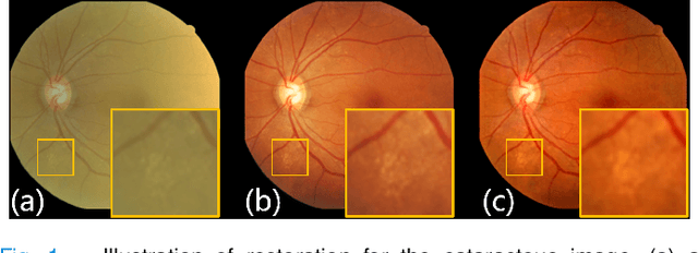 Figure 1 for An Annotation-free Restoration Network for Cataractous Fundus Images