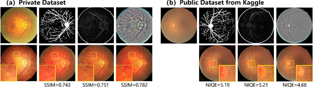 Figure 4 for An Annotation-free Restoration Network for Cataractous Fundus Images