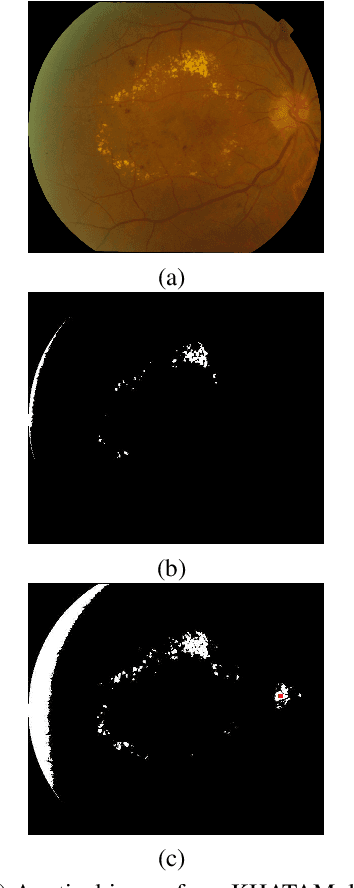 Figure 1 for An adaptive thresholding approach for automatic optic disk segmentation