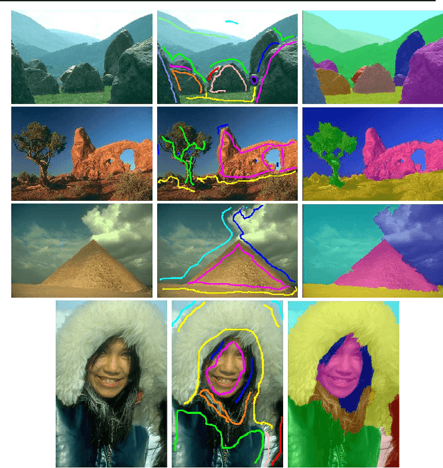 Figure 4 for A New Algorithm for Interactive Structural Image Segmentation