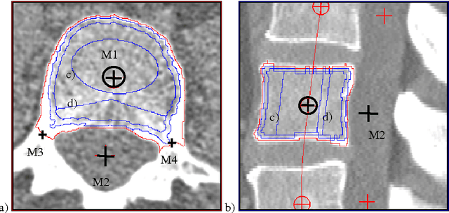 Figure 1 for A New 3D Segmentation Methodology for Lumbar Vertebral Bodies for the Measurement of BMD and Geometry