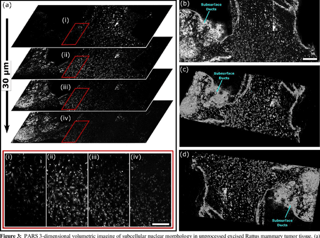 Figure 3 for Three-Dimensional Virtual Histology in Unprocessed Resected Tissues with Photoacoustic Remote Sensing (PARS) Microscopy and Optical Coherence Tomography
