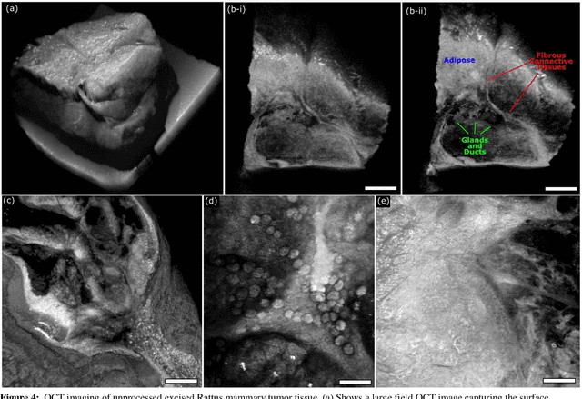 Figure 4 for Three-Dimensional Virtual Histology in Unprocessed Resected Tissues with Photoacoustic Remote Sensing (PARS) Microscopy and Optical Coherence Tomography