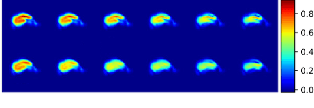 Figure 4 for Event-Based Modeling with High-Dimensional Imaging Biomarkers for Estimating Spatial Progression of Dementia