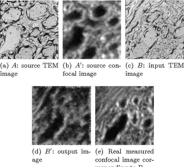 Figure 4 for Multi-modal Image Registration for Correlative Microscopy