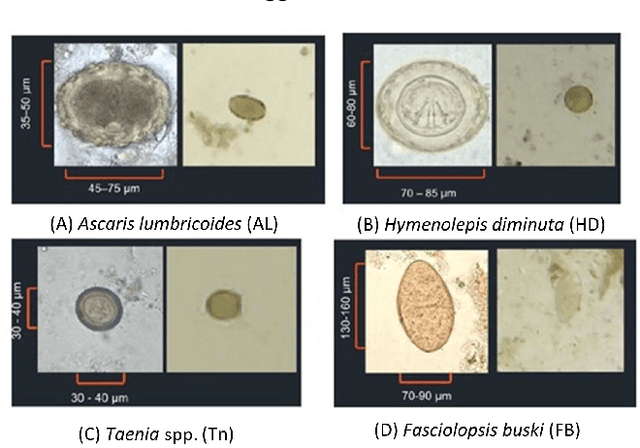 Figure 1 for Parasitic Egg Detection and Classification in Low-cost Microscopic Images using Transfer Learning