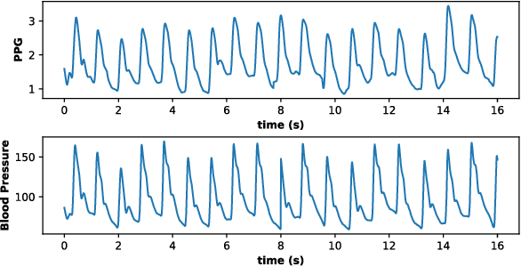 Figure 3 for A Deep Learning Approach to Predict Blood Pressure from PPG Signals