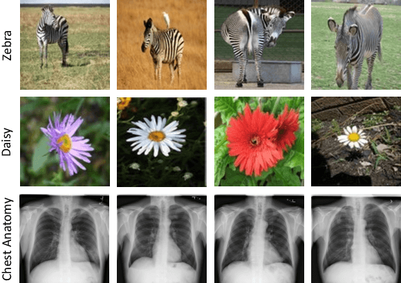 Figure 3 for DiRA: Discriminative, Restorative, and Adversarial Learning for Self-supervised Medical Image Analysis