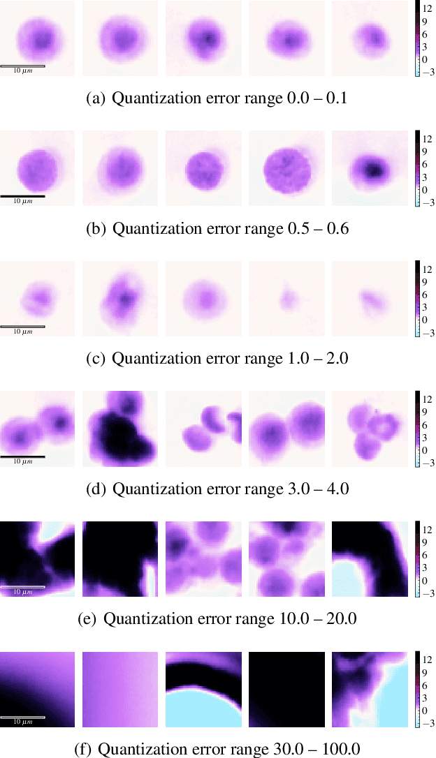 Figure 2 for Outlier Detection using Self-Organizing Maps for Automated Blood Cell Analysis