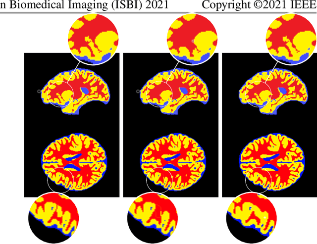 Figure 3 for MDA-Net: Multi-Dimensional Attention-Based Neural Network for 3D Image Segmentation