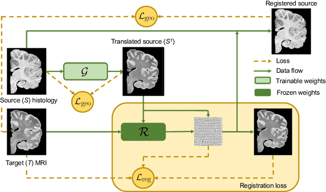 Figure 1 for Synth-by-Reg (SbR): Contrastive learning for synthesis-based registration of paired images